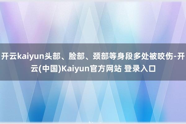 开云kaiyun头部、脸部、颈部等身段多处被咬伤-开云(中国)Kaiyun官方网站 登录入口