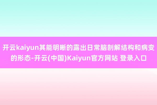 开云kaiyun其能明晰的露出日常脑剖解结构和病变的形态-开云(中国)Kaiyun官方网站 登录入口